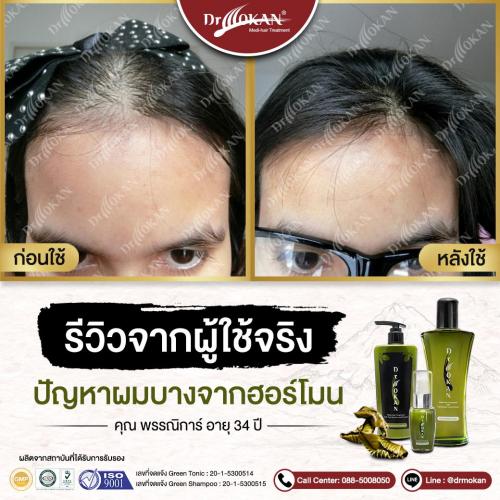 คุณพรรณิการ์ 