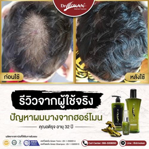 คุณอติรุจ