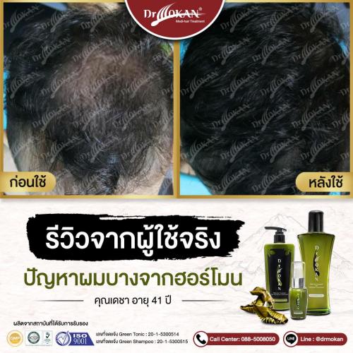 คุณเดชา