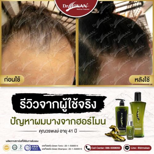 คุณวรพงษ์