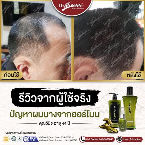 คุณวินิจ