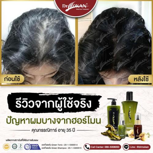 คุณกรรณิการ์