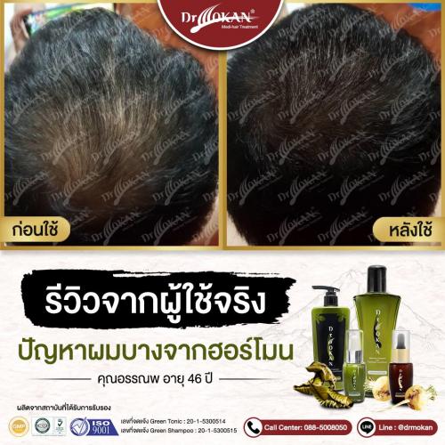 คุณอรรณพ