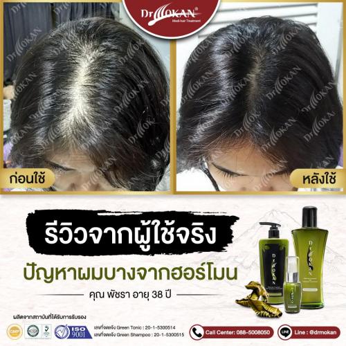 คุณพัชรา