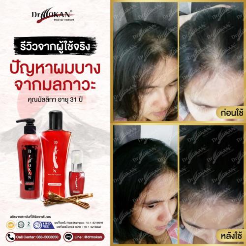 คุณมัลลิกา