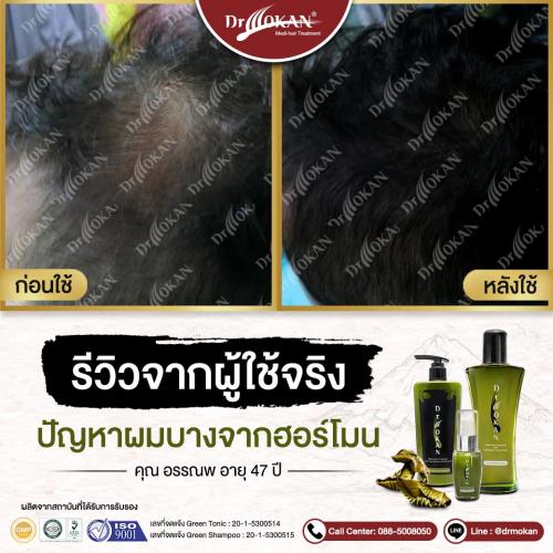 คุณอรรณพ