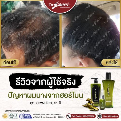 คุณสุรพงษ์